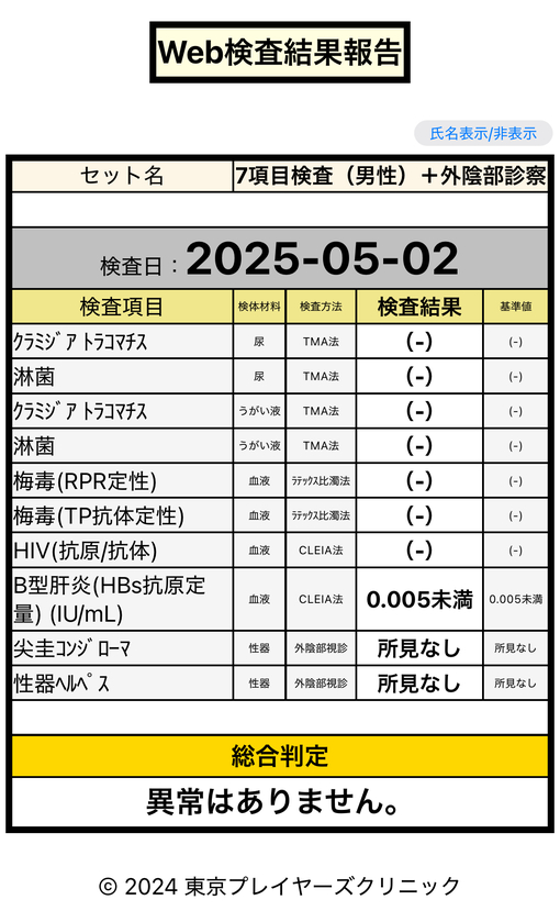 HOKUTO(ホクト) 4月定期検査報告