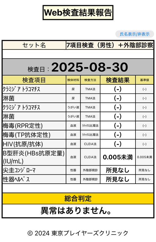 HOKUTO(ホクト) 8月定期検査報告②